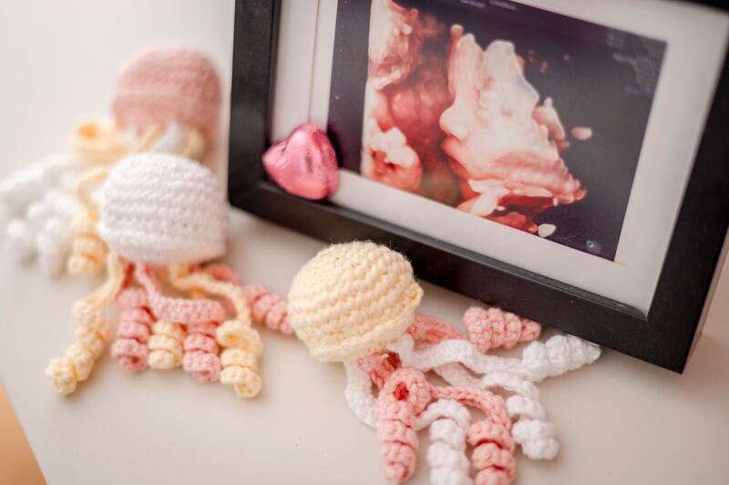 A sonogram of Ivana Bronlund’s baby at her home in Hedehusene, Denmark. Photograph: Hilary Swift/New York Times