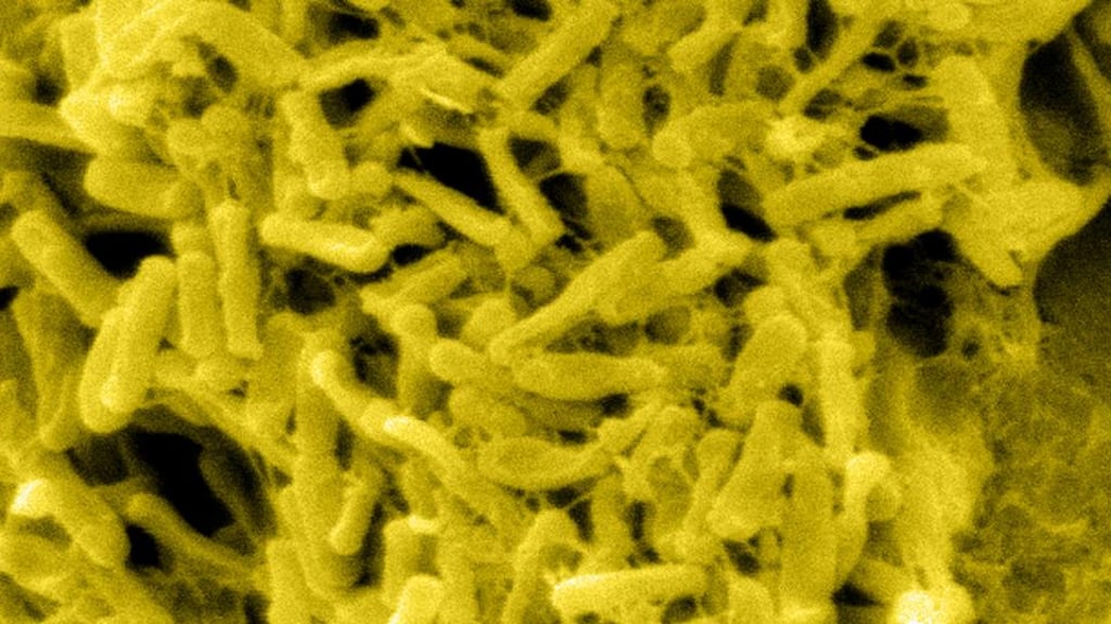 Scanning electron micrograph of gram-positive Clostridium difficile bacteria. File photograph: Getty Images/Kallista Images