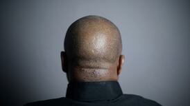 Rights body urges action on direct provision reform