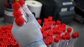 Some long Covid patients show signs of autoimmune disease, study finds