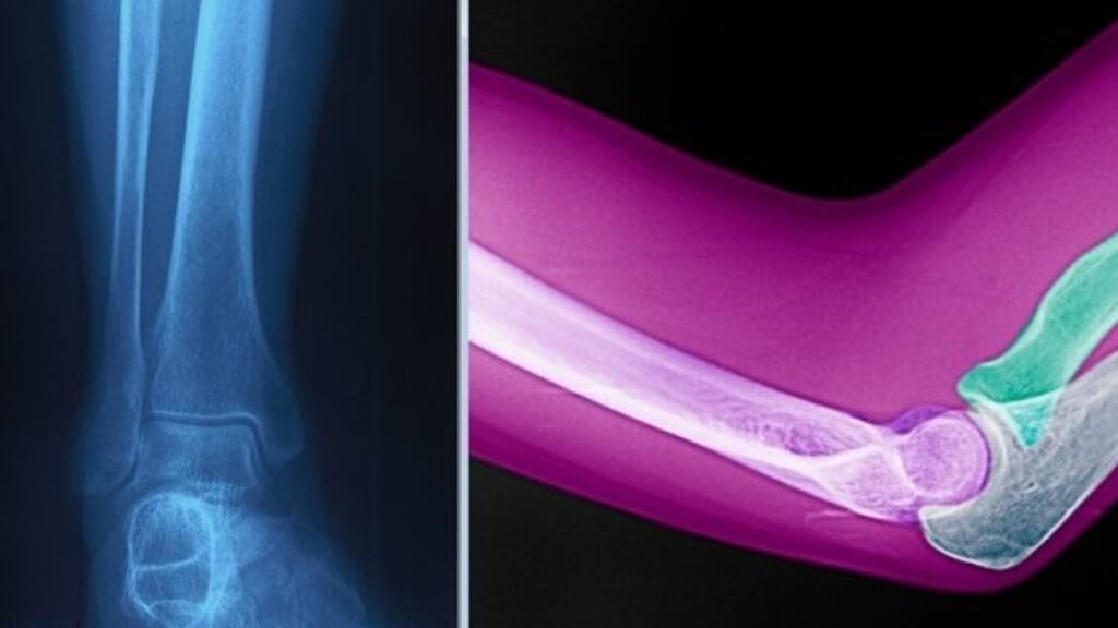 On confusing an X-ray of an ankle for an image of an elbow during a training session with colleagues, Dr Hassan said it was a “teaching meeting – in a teaching environment. It’s a chance for people to make mistakes and learn more”. Photograph: Getty Images