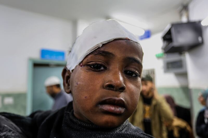 An injured child at al-Najjar hospital in Rafah following an Israeli strike on the city's Omar Ibn Abdul Aziz mosque on January 24th. Photograph: Abed Rahim Khatib/Anadolu via Getty Images