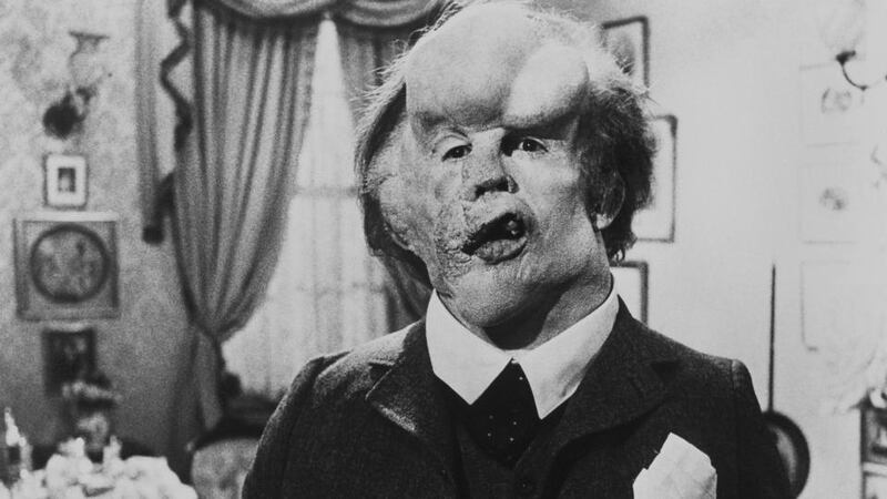 The Elephant Man: John Hurt as John Merrick in David Lynch’s film