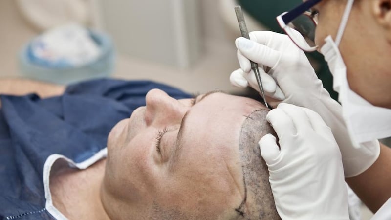 On being told that local anaesthetics are used, I wonder how badly it hurts. Photographs: iStock