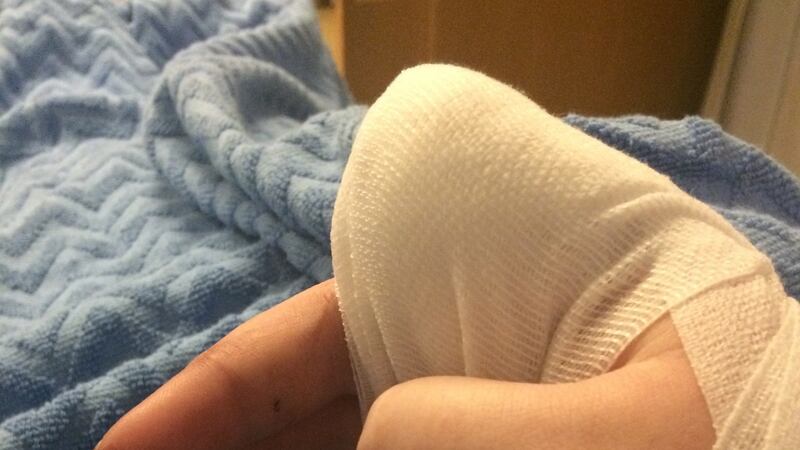 Megan Cullen (25) cut off her own right index finger after suffering eight years of chronic pain