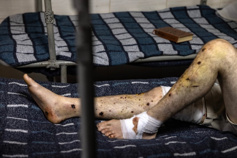 A wounded Russian prisoner of war in a Ukrainian prison cell in northern Ukraine on Friday, August 16th, 2024. Photograph: David Guttenfelder/The New York Times