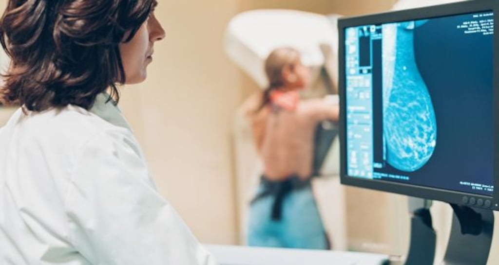 The pandemic ‘disrupted every single part of the cancer care continuum from screening to diagnostics to treatment and end-of-life care,’ Averil Power said. Photograph: iStock