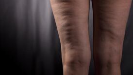 Naturally . . . Smoother skin