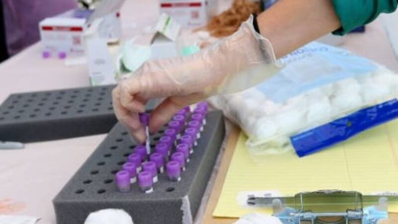 First human trials of Oxford Covid-19 vaccine suggest it is safe