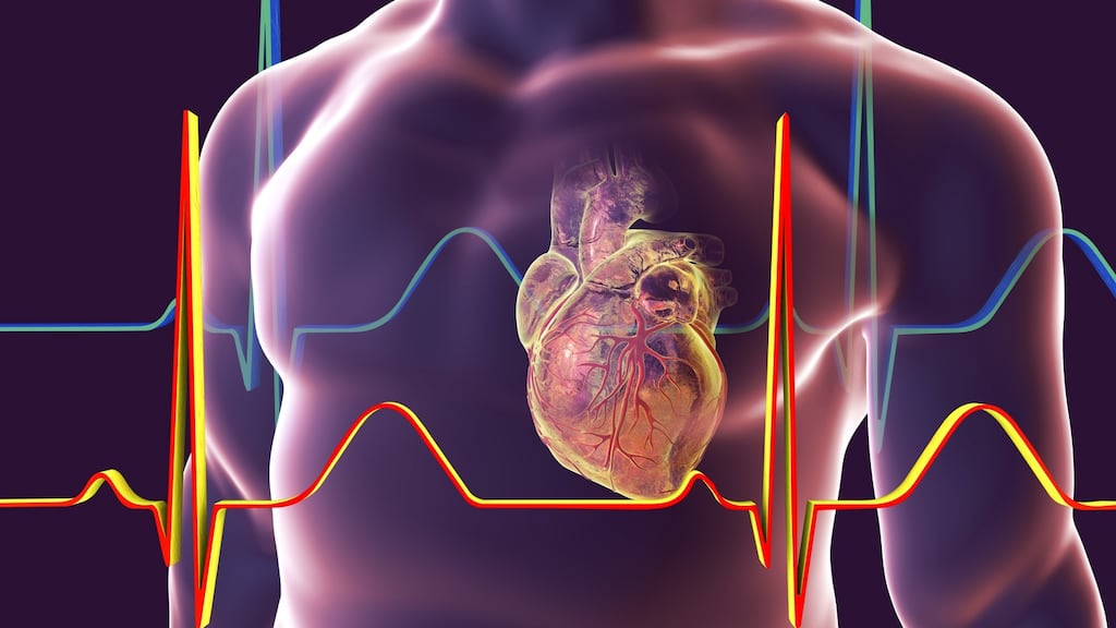 Physical activity may, paradoxically, hasten your risk of a heart attack, a new study suggests. File photograph: Getty Images