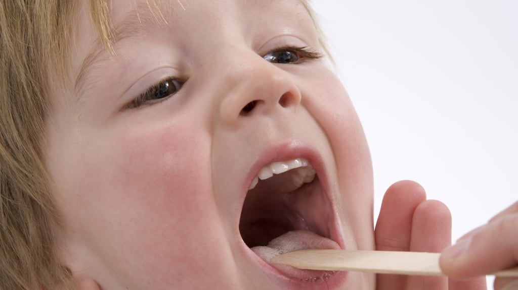 Among children with frequent recurrences of tonsillitis, those who undergo tonsillectomy have a better quality of life compared with those who don’t. Photograph: iStockphoto