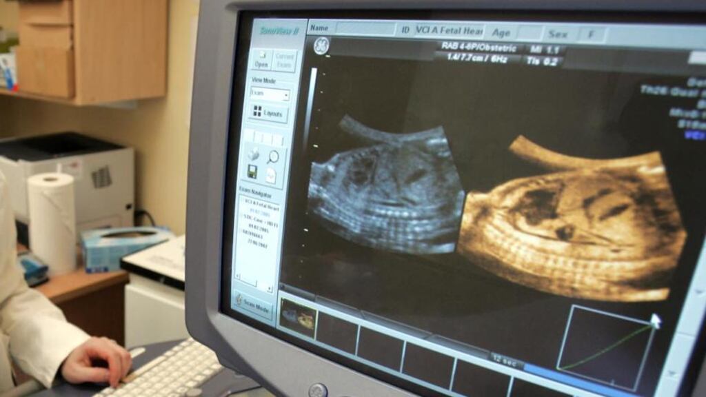 In two known cases since 2001, staff at hospitals in Waterford and Galway kept pregnant women on life support as a result of uncertainty over the hospitals’ obligation to the foetus. Photograph: Eric Luke/The Irish Times