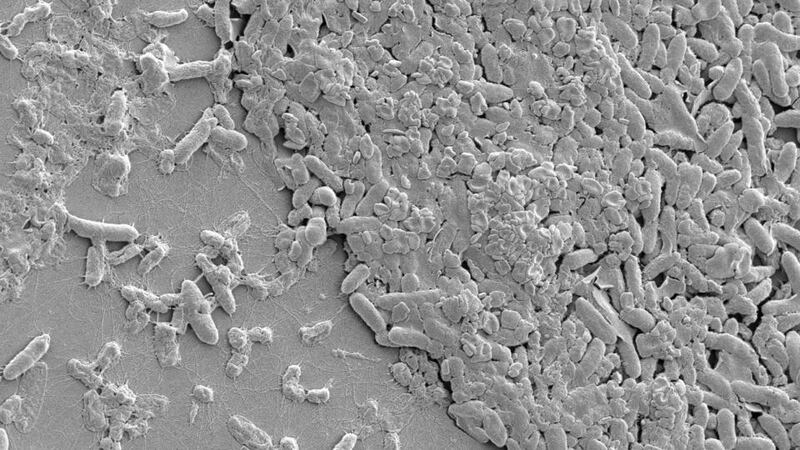 An image of the Pseudomonas aeruginosa superbug magnified 5,000 times. Photograph: Queen’s University Belfast