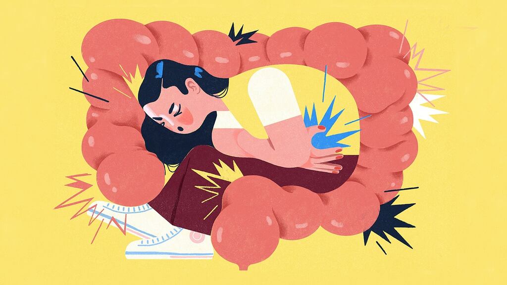 IBS is the most frequently diagnosed gastrointestinal disorder. Illustration: Gracia Lam/The New York Times