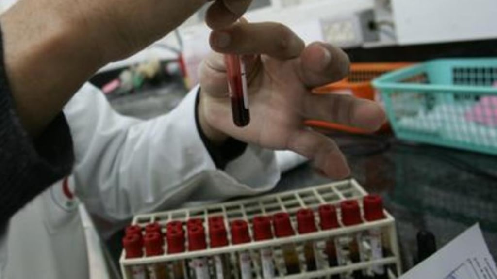 Members of the Medical Laboratory Scientists Association (MLSA) voted in favour of the Haddington Road proposals by 62 per cent to 38 per cent.