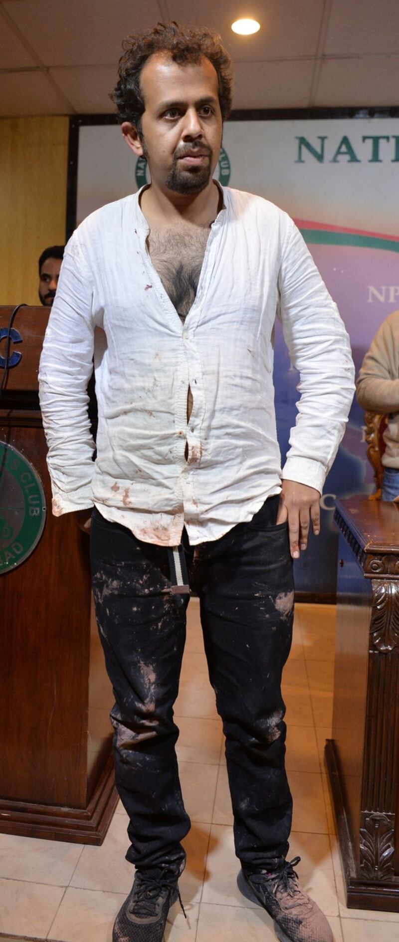 Pakistani journalist Taha Siddiqui arrives for a press conference after being assaulted by armed men in Islamabad. Photograph: Aamir Qureshi/AFP/Getty Images