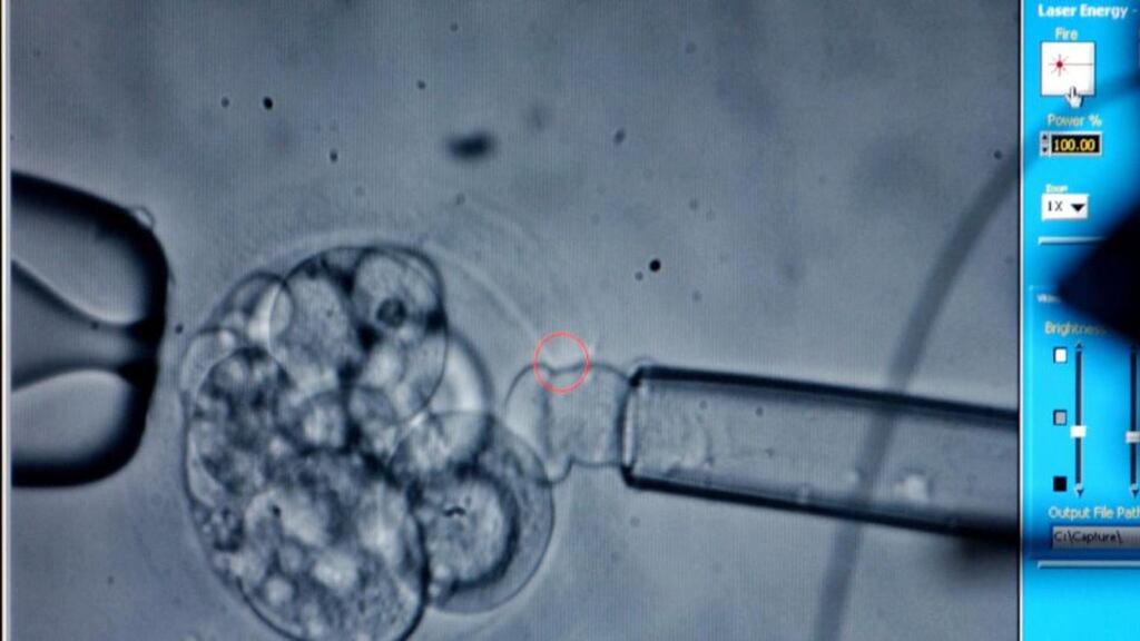 Preimplantation genetic diagnosis (PGD): used in conjunction with IVF to screen embryos for specific genetic disorders before they are implanted into a woman to try to achieve a pregancy. Photograph: Bill Davis/Newsday