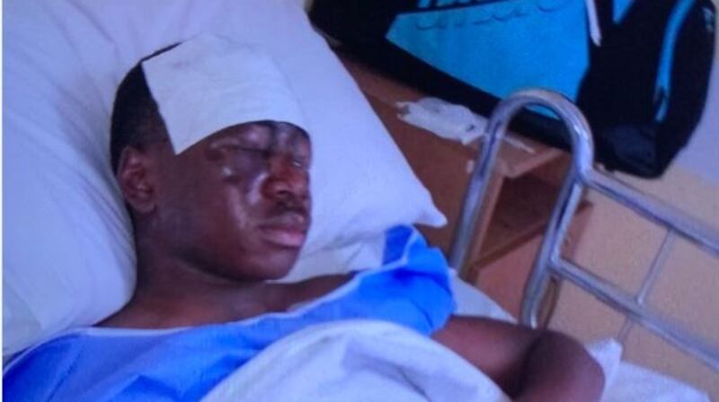 Tega Agberhiere (17) was brought to Cork University Hospital. Photograph: Damian Tiernan via Twitter