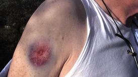 Irish cameraman hurt after being shot by Israeli soldier