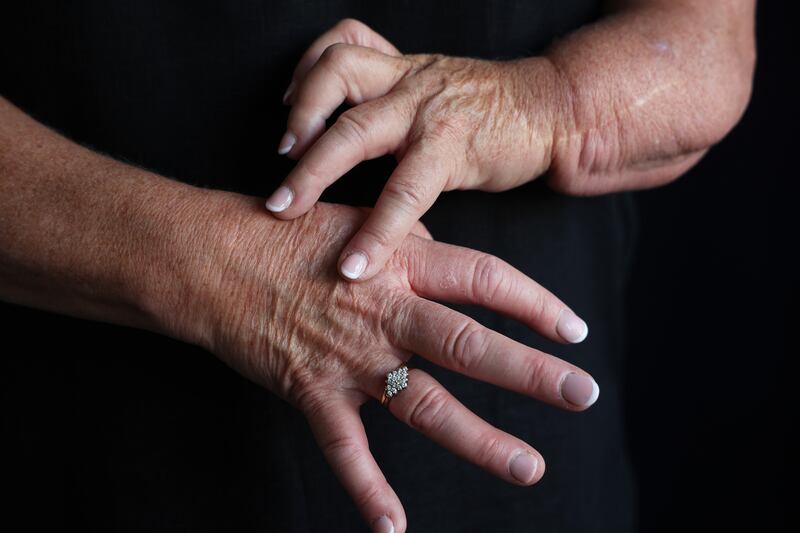 Finola Cassidy: 'I remember trying to learn to say and spell this new word.' Photograph: Nick Bradshaw