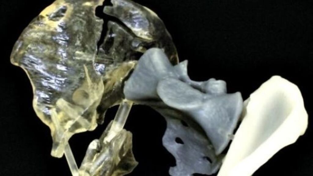 Axial 3D, which prints precise anatomical models from scans, was among the NI tech companies to secure funding last year