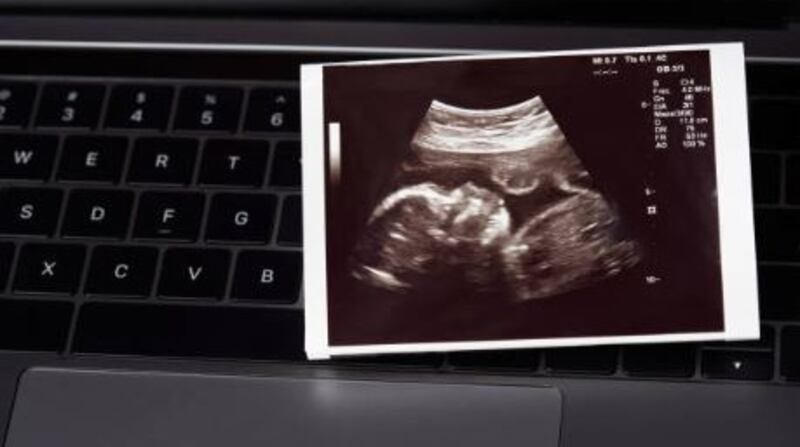 The helpline will go live on January 1st, and information will be distributed to GPs and hospitals over the coming days.  File photograph: iStockPhoto