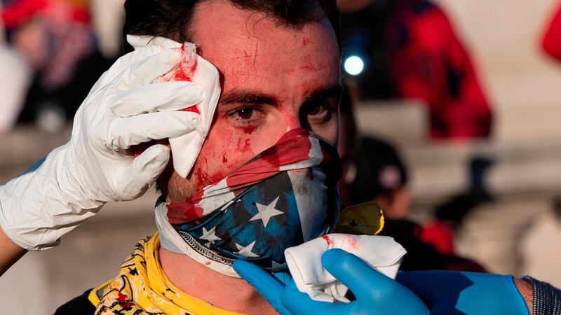 An injured supporter of Donald Trump is helped after being assaulted by an unknown assailant in Washington on Saturday. Photograph: Andrew Caballero-Reynolds/AFPGetty Images