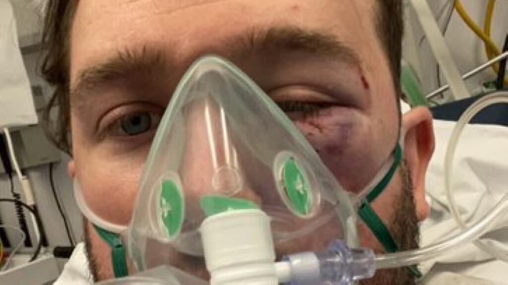 Evan Somers recovers in hospital following an assault in Dublin. Photograph via Twitter