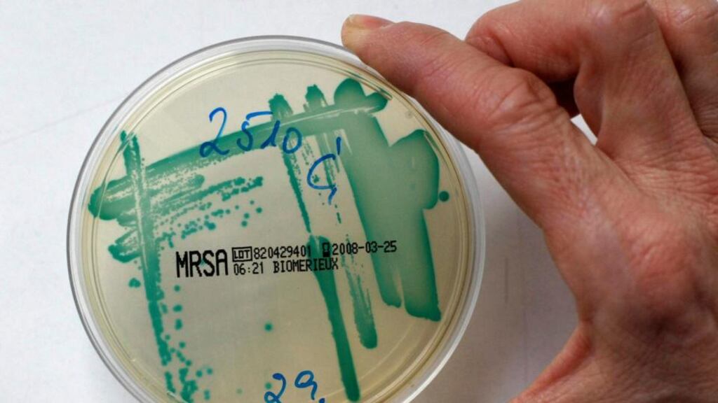 An MRSA bacteria strain in a petri dish. Photograph: Fabrizio Bensch/Files/Reuters