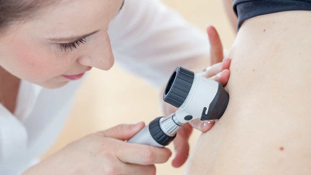 Metastatic melanoma, where the cancer has spread within the body, is one of the most serious types of skin cancer. Photograph: iStock