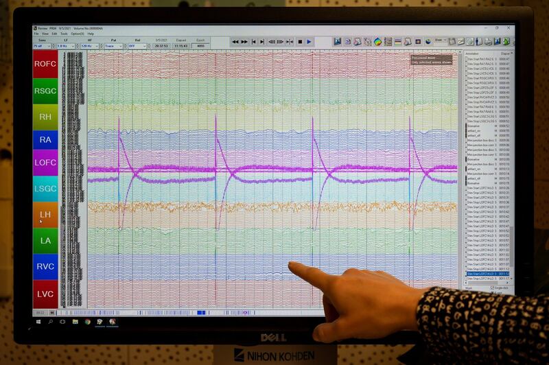 Dr Katherine Scangos examines a graph of Sarah’s brain activity. Photograph: Mike Kai Chen/New York Times