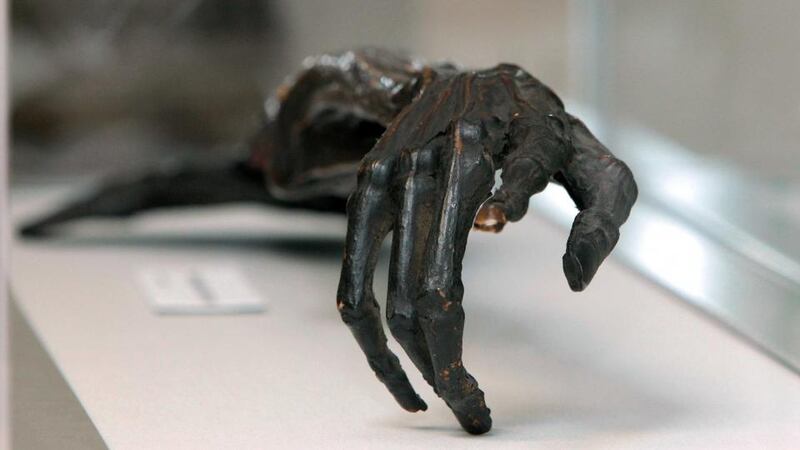 Tthe mummified right hand of Dan Donnelly from the exhibition, entitled The Fighting Irishmen: Celebrating Celtic Prizefighters 1820 to Present. Photograph: Morgan Treacy/Inpho