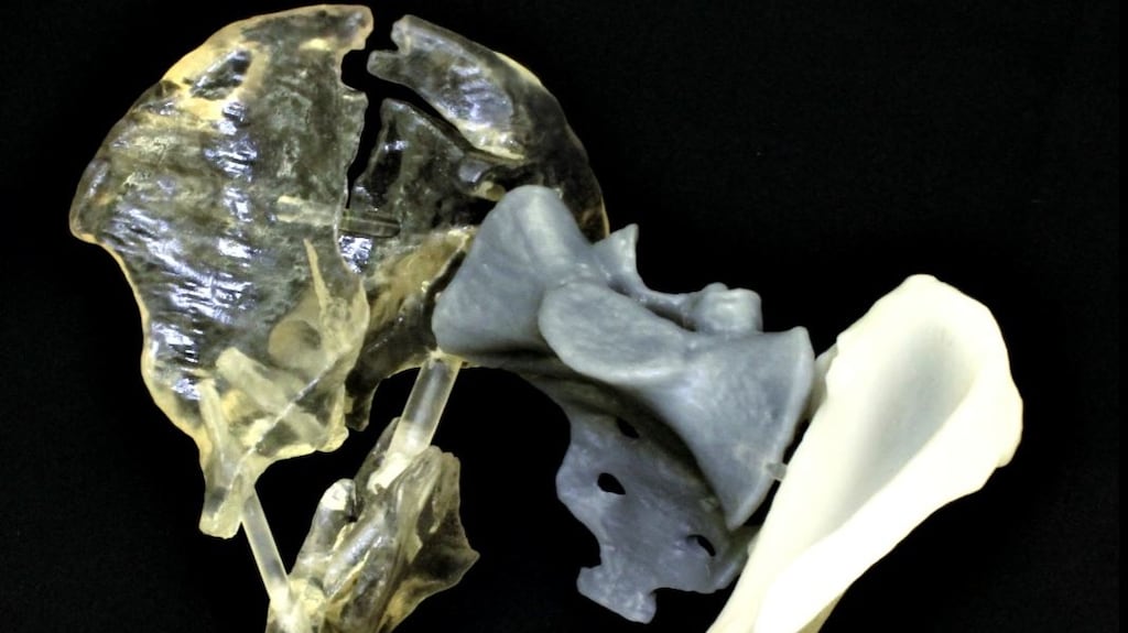 Axial3D the Belfast based medical technology firm, specialises in 3D printing within the healthcare sector