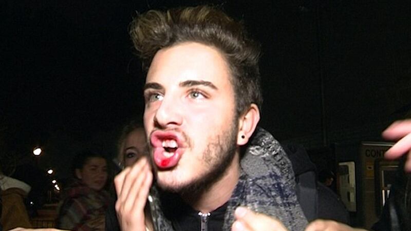 The unidentified teenager in the video is seen holding his lip after the incident. Screengrab: TMZ, via YouTube