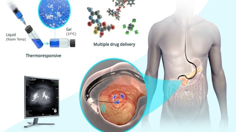 “ChemoGel is a unique type of hydrogel, referred to as heat responsive, and is liquid at room temperature and semi-solid at body temperature,” Helena Kelly says