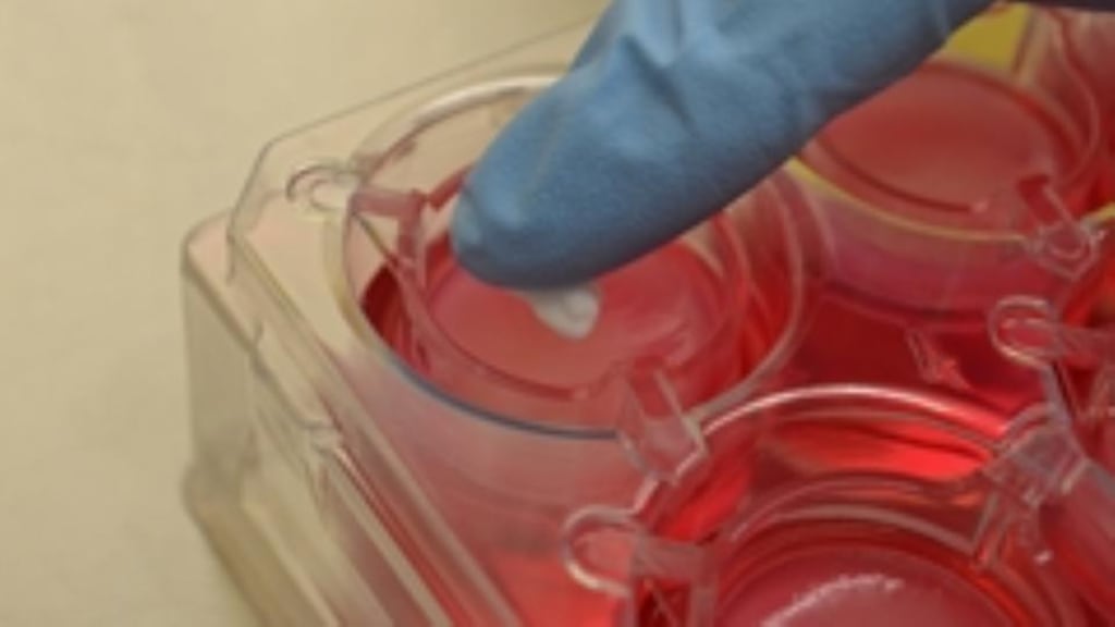 Lightstone has already invested in Ireland, co-investing alongside global healthcare leader Covidien, venture capital firm New Enterprise Associates and leading medical device incubator The Foundry, in a new company called FIRE1 to be based in Dublin. FIRE1 will focus on developing novel therapeutic devices.