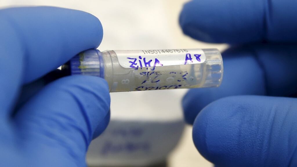 A health technician analyzes a blood sample from a patient bitten by a mosquito at the National Institute of Health in Lima, Peru. Two adults have been confirmed with the Zika virus in Ireland but are said to have fully recovered. Photograph: Mariana Bazo/Files/Reuters.