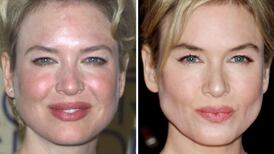 Spare your blushes: five skincare products for rosacea