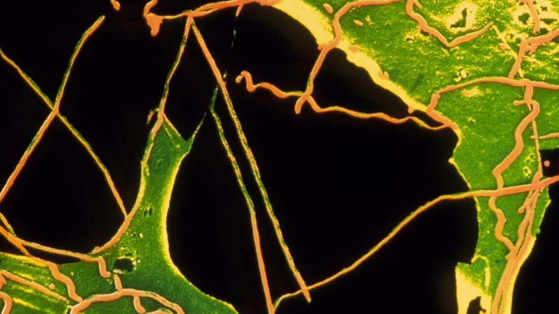 The rise and fall of western syphilisation – An Irishman’s Diary about a once-dreaded disease