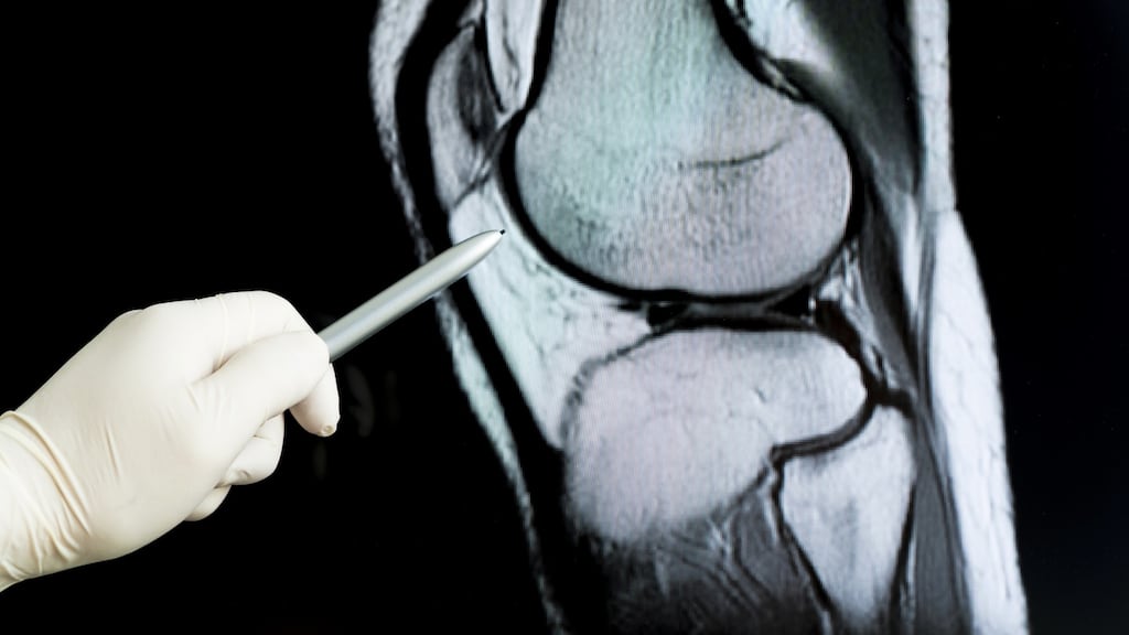 People over 50 who break bones easily should be assessed for osteoporosis, which includes a DXA scan. Photograph: iStockphoto