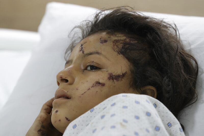 A child is treated for wounds suffered in an Israeli strike on the southern Lebanese village of Saksakiyeh on September 24th. Photograph: Mahmoud Zayyat/AFP via Getty Images