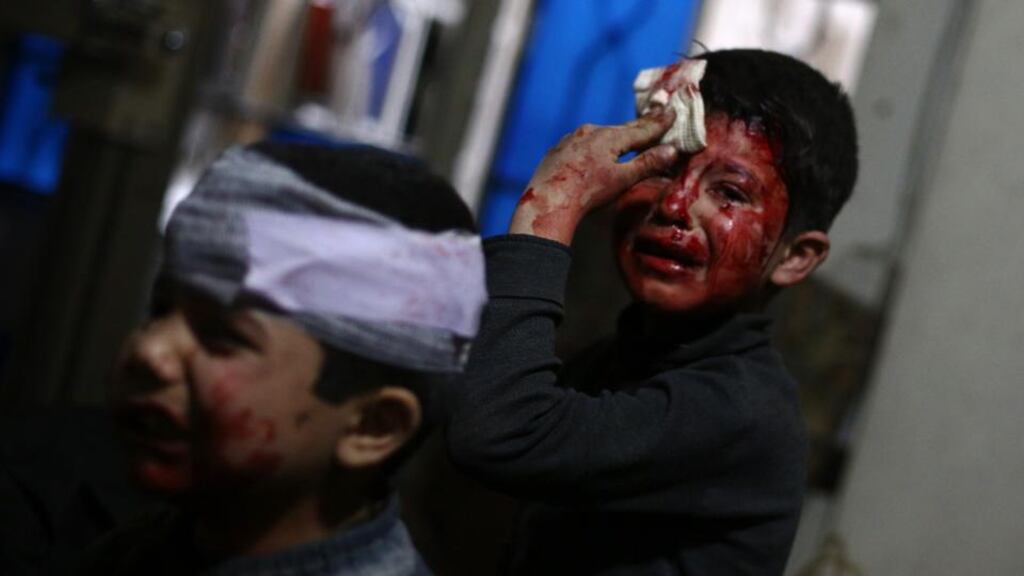 Life in a war zone: wounded children at a clinic in Douma. Photograph: Abd Doumany/AFP/Getty