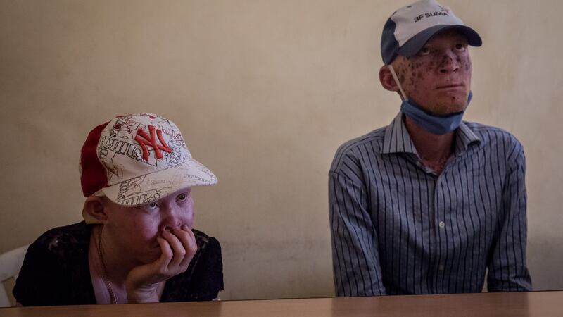 Activists in Gulu, Uganda appeal for help for people with albinism, who they say are particularly vulnerable during the Covid-19 pandemic because they can’t access suncream. Photograph: Sally Hayden