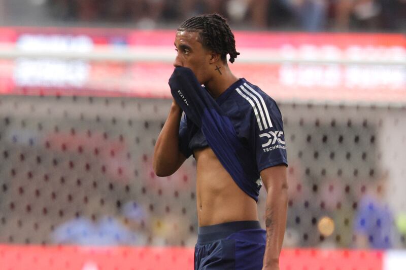 Leny Yoro, the new £52m flagship signing for Manchester United, broke a foot, so the defender is out for three months. Photograph: EPA