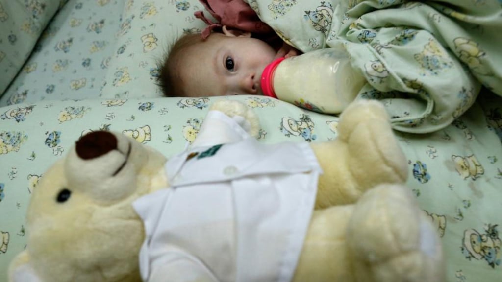 Pattaramon Chanbua’s son Gammy, who was born with Down syndrome and a hole in his heart. Photograph: EPA/Rungroj Yongrit