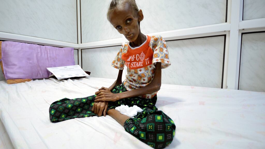 Saida Ahmad Baghili (18) who is affected by severe acute malnutrition, sits on a bed at the al-Thawra hospital in the Red Sea port city of Houdieda, Yemen. Photograph: Abduljabbar Zeyad/Reuters