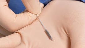 Bypassing surgery for new cardiac treatment