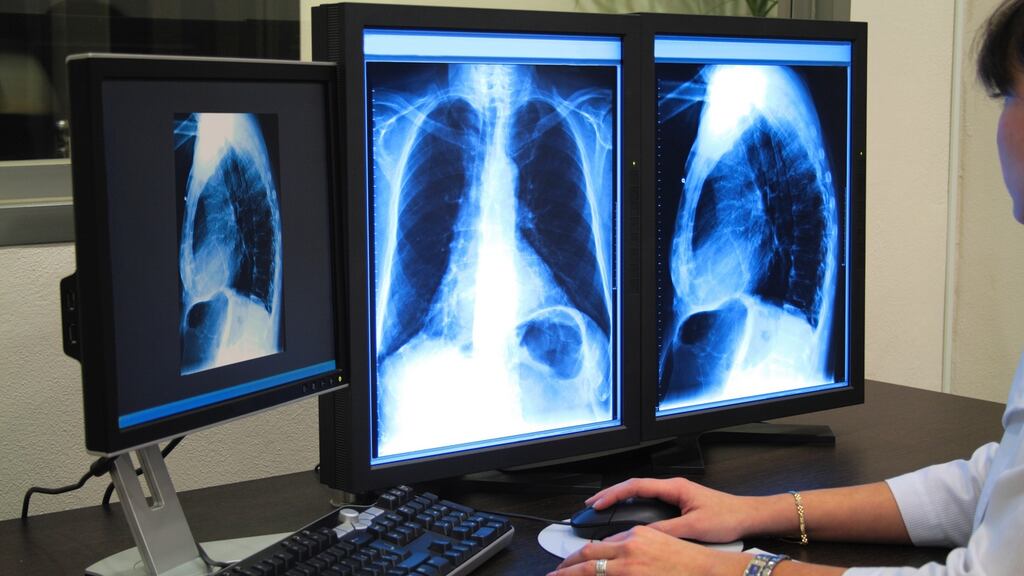 The HSE’s National Integrated Medical Imaging System is used to store radiology, cardiology and other diagnostic images electronically. When images are archived, the “<”, used in a report, was omitted and was not visible.