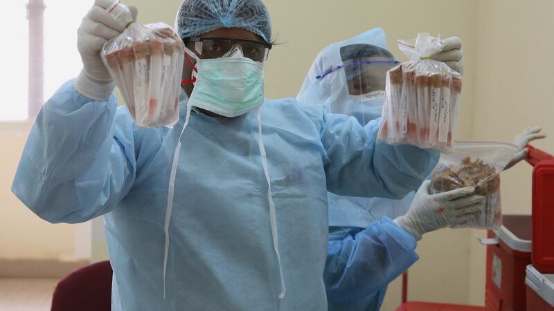 A doctor displays collected samples before conducting Covid-19 routine testing at a hospital in Bangalore, India, April 25th. Photograph: Jagadeesh Nv/EPA