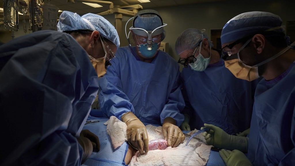 Pig kidney: a surgical team at the hospital in New York examine the organ attached to the body of a deceased recipient for any signs of rejection. Photograph: Joe Carrotta/NYU Langone Health via AP Wire